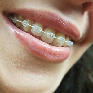 Dental